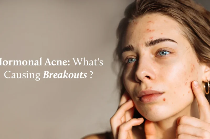 Clear Skin, Calm Mind: How Ayurveda Helped Me Beat Hormonal Acne